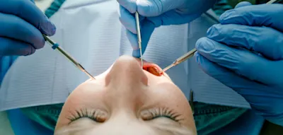 CDU-Wirtschaftsrat will B&uuml;rger den Zahnarztbesuch selbst zahlen lassen